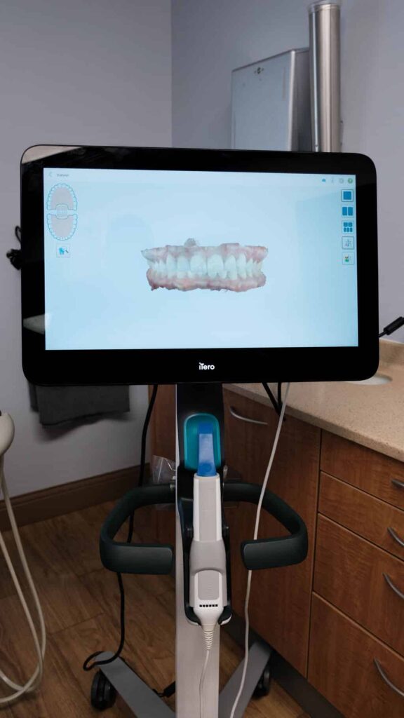 Monitor showing dental implants teeth on screen in Orange Park